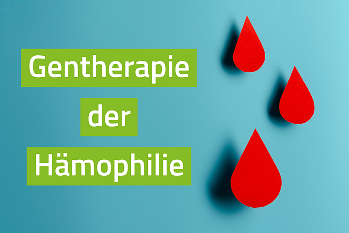 Cover Nutzenorientierte Preisverhandlungen zur Gentherapie
